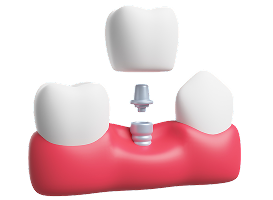 Services Golden Oaks Dental - goldenoaksdental.com