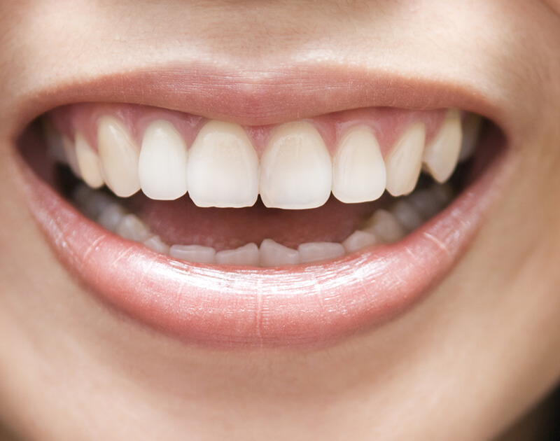 Home Golden Oaks Dental - goldenoaksdental.com