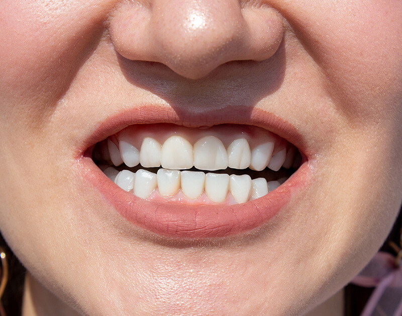 Home Golden Oaks Dental - goldenoaksdental.com