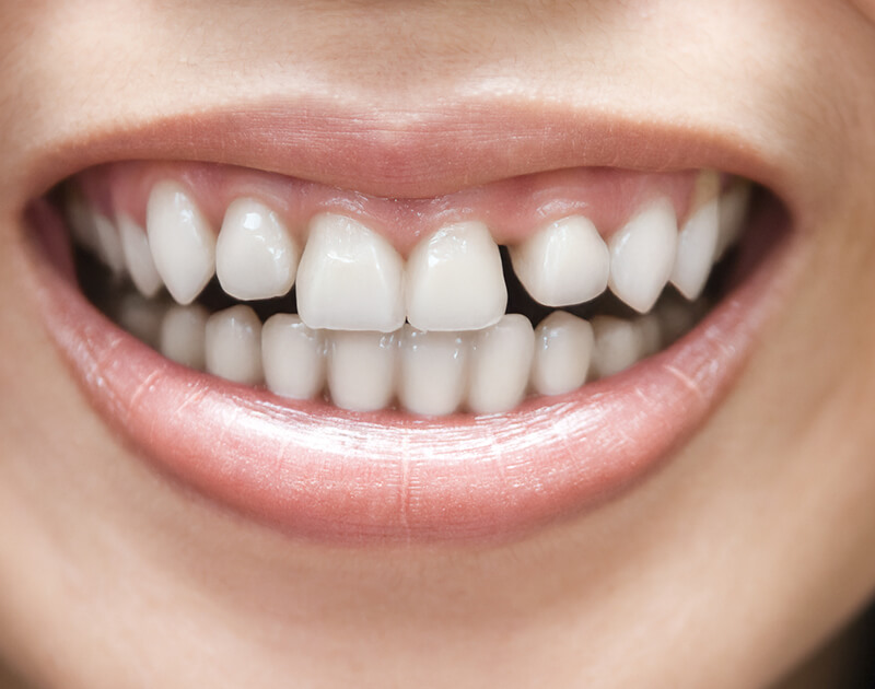 Home Golden Oaks Dental - goldenoaksdental.com