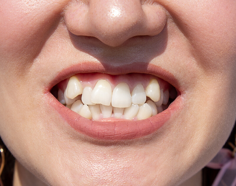 Home Golden Oaks Dental - goldenoaksdental.com